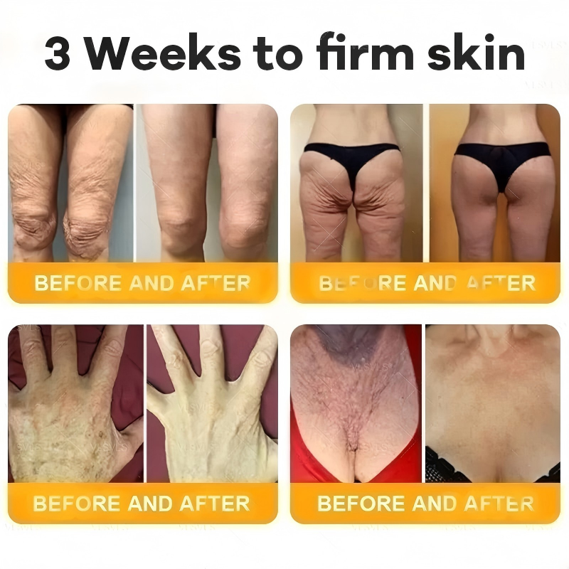 Made and Shipped from USA  ⭐✨  VIREXO® Bee Venom Comprehensive Cream  LAST DAY 80% OFF(Sagging Skin, Fine Lines, Loss of Firmness, Flat Bust, Drooping Hips, and More)