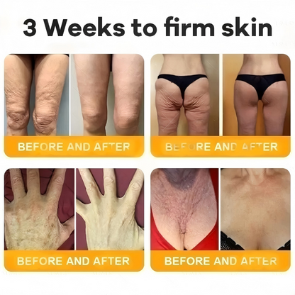 Made and Shipped from USA  ⭐✨  VIREXO® Bee Venom Comprehensive Cream  LAST DAY 80% OFF(Sagging Skin, Fine Lines, Loss of Firmness, Flat Bust, Drooping Hips, and More)