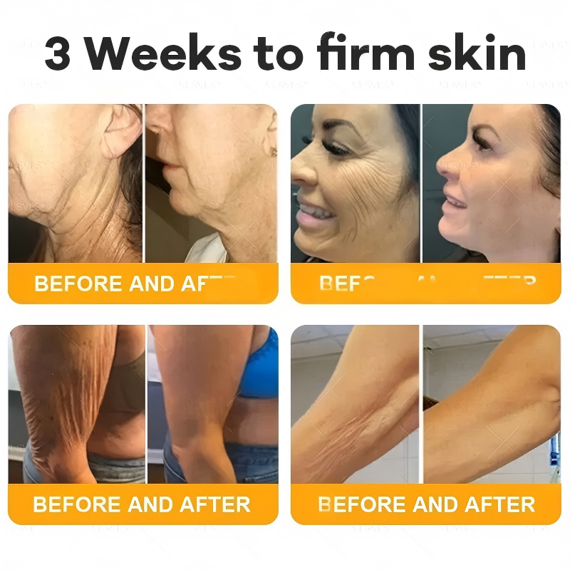 Made and Shipped from USA  ⭐✨  VIREXO® Bee Venom Comprehensive Cream  LAST DAY 80% OFF(Sagging Skin, Fine Lines, Loss of Firmness, Flat Bust, Drooping Hips, and More)