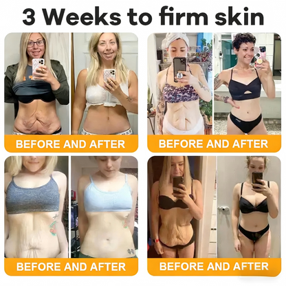 Made and Shipped from USA  ⭐✨  VIREXO® Bee Venom Comprehensive Cream  LAST DAY 80% OFF(Sagging Skin, Fine Lines, Loss of Firmness, Flat Bust, Drooping Hips, and More)